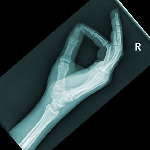 Hand x-ray